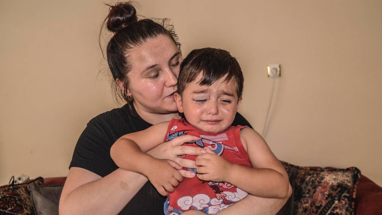 Kastamonu'da Köpeklerin Saldırdığı 3 Yaşındaki Miraç Yaralandı