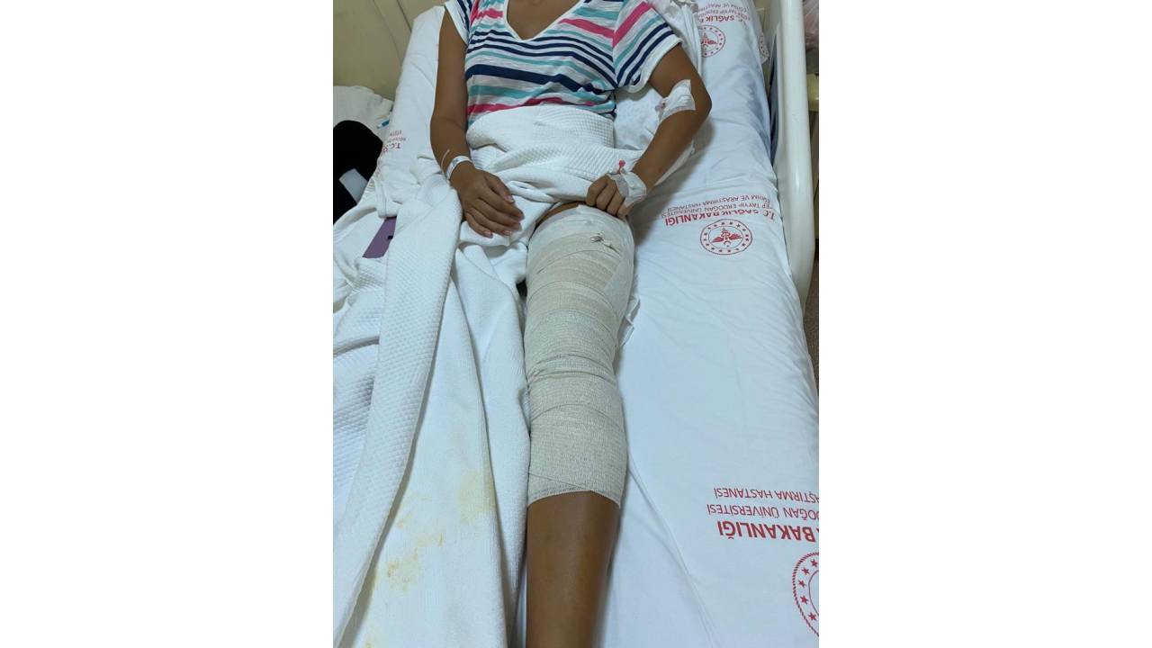 Ece'nin Bacağına, Yüzerken Yorgun Mermi İsabet Etti