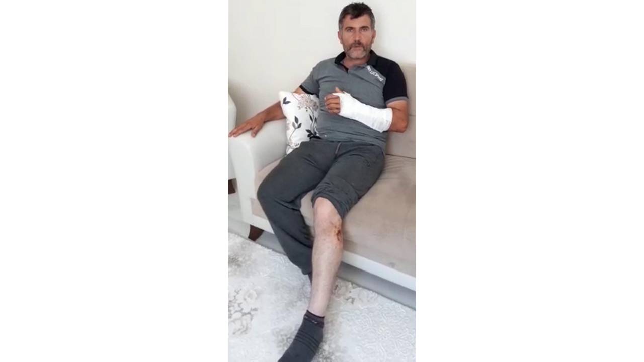 Öldüğünü Zannettiği Ayının Saldırısına Uğradı