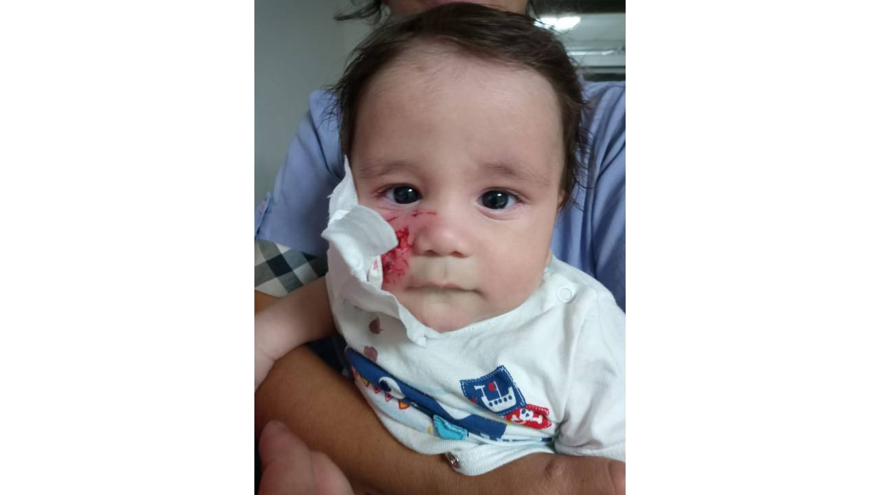 Şenlikte Atın Isırdığı Bebek Yaralandı