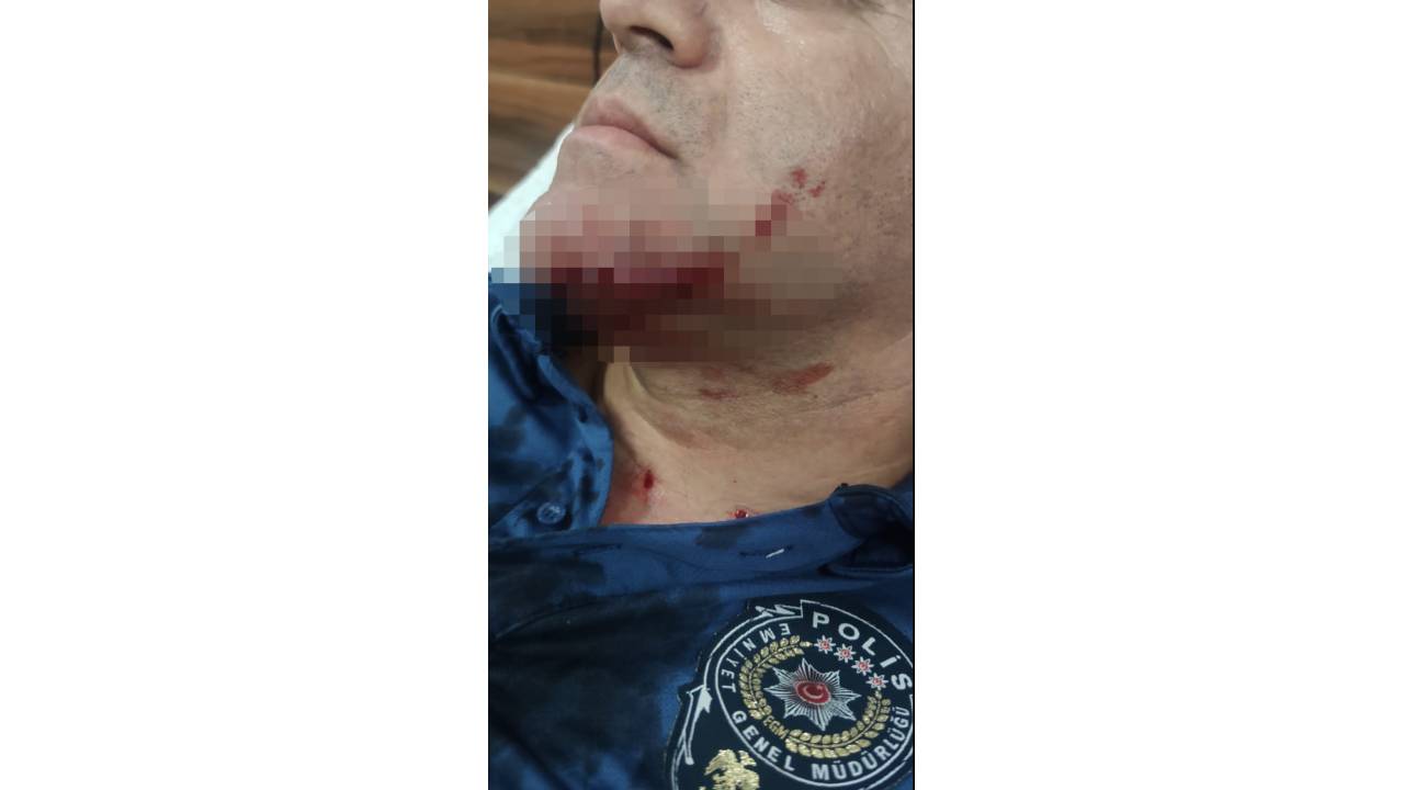 Polisi Bıçakla Yüzünden Yaralayan Saldırgan Serbest