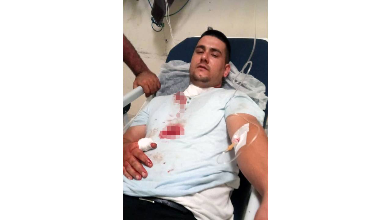 Otomobilini Park Ederken Bıçaklı Saldırıya Uğradı