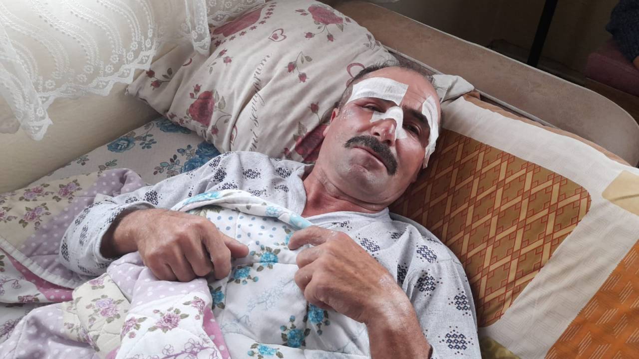 Kazada Dili Boğazına Kaçan Motosikletli: Hiçbir Şey Hatırlamıyorum