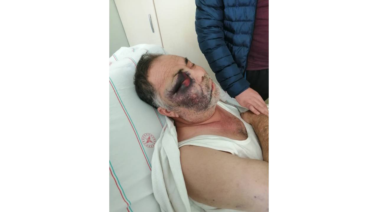 Engelliyi Döverek Öldürmekle Suçlanan Baba-oğlun Beraatine İtiraza Ret