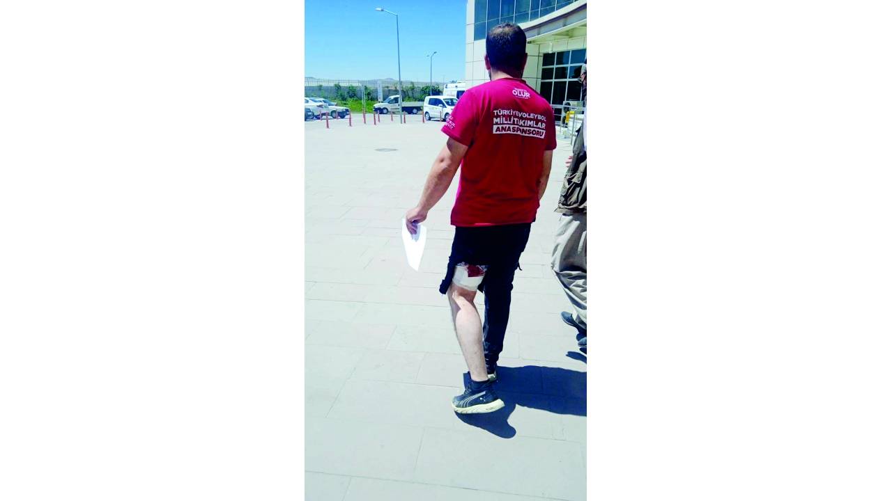 Servis İçin Gittiği Evin Önünde Köpek Saldırdı, Bacağından Yaralandı